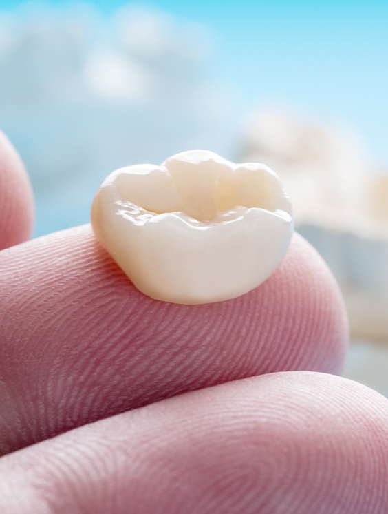 Close up of a dental crown resting on a person's finger