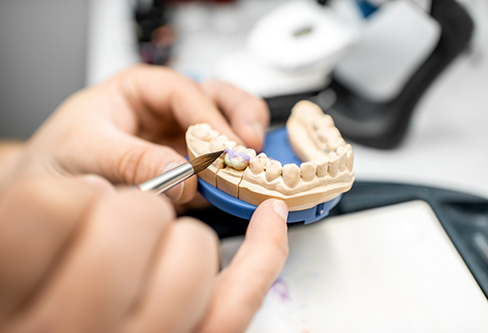 Dental lab worker adjusting a dental crown