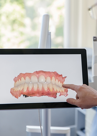Hand pointing to a screen showing a digital model of teeth