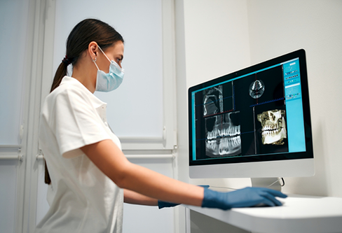 Dental professional looking at several x rays of a patient's teeth on a computer