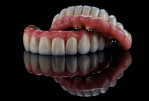 Set of full dentures with attachments for dental implants