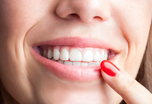 Close up of a person with flawless teeth pointing to their smile