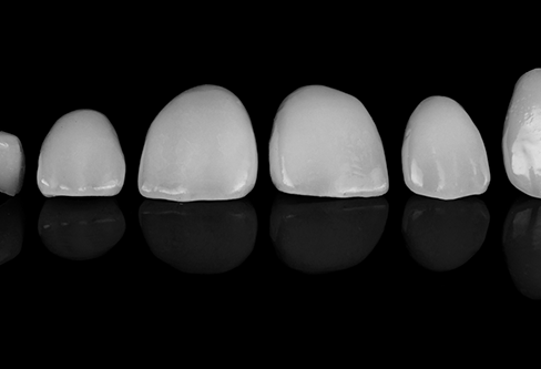 Several white tooth shaped shells against a black background