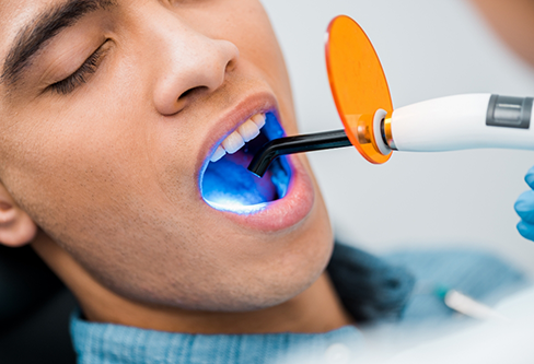 Dental patient having an ultraviolet light being applied to his tooth