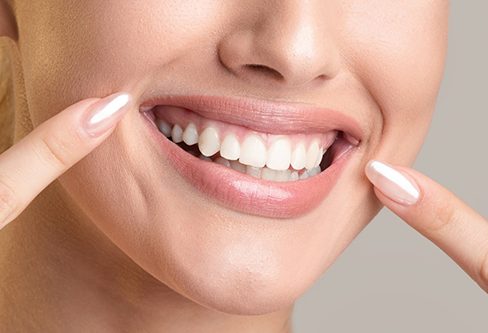Person with flawless teeth pointing to their smile