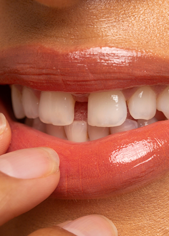 Close up of a mouth with a small gap between the two front teeth