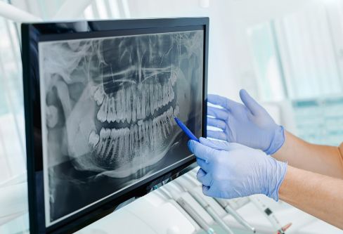 Dentist gesturing to a screen showing x rays of a patient's teeth
