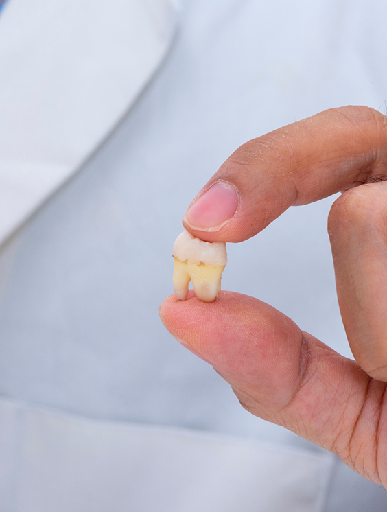 Hand holding an extracted tooth